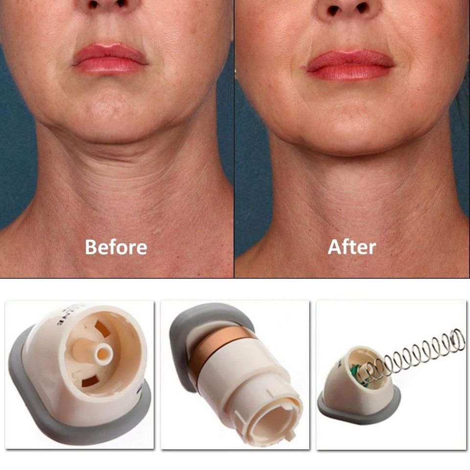 REDUCTOR DE PAPADA Y MASAJEADOR DE CUELLO